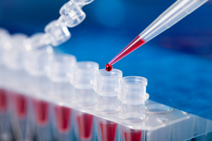 Pipetten, © science photo, Shutterstock Mikroliterpipette tropft in ein PCR-Röhrchen